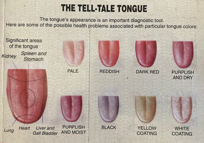 Ayurvedic Tongue Diagnosis
